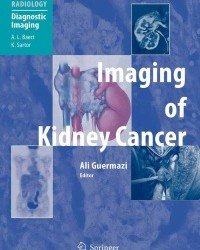 Ali Guermazi - Imaging of Kidney Cancer