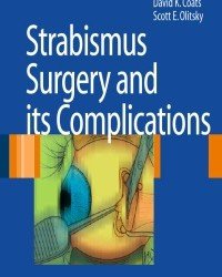 David K. Coats - Strabismus Surgery and Its Complications