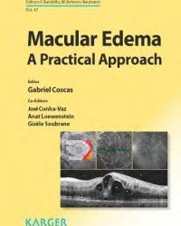 Gabriel Coscas - Macular Edema. A Practical Approach