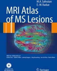 M. A. Sahraian - MRI Atlas of MS Lesions