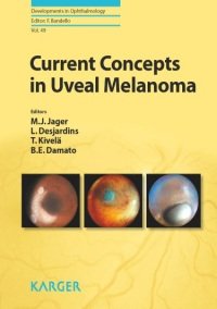 Martine J. Jager - Current Concepts in Uveal Melanoma