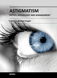 Michael Goggin - Astigmatism. Optics, Physiology and Management