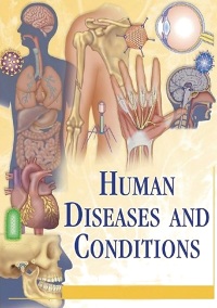 Miranda Herbert Ferrara - Human Diseases and Conditions (Second edition)