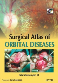 S. Mallajosyula - Surgical Atlas of Orbital Diseases
