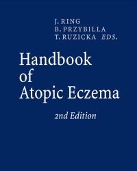 J. Ring - Handbook Of Atopic Eczema (Second edition)