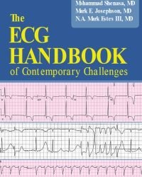 M. Shenasa - The ECG Handbook of Contemporary Challenges (2015)