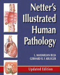 L. Buja - Netters Illustrated Human Pathology (2014)