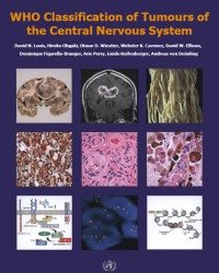 D. Hiroko - WHO Classification of Tumours of the Central Nervous System (2016)