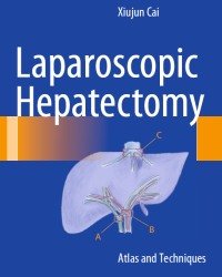 X. Cai - Laparoscopic Hepatectomy (2015)