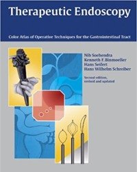 Nib Soehendra - Therapeutic Endoscopy
