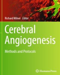 R. Milner - Cerebral Angiogenesis (2014)