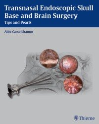 A. Stamm - Transnasal Endoscopic Skull Base and Brain Surgery