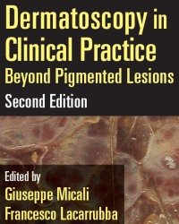 G. Micali - Dermatoscopy in Clinical Practice