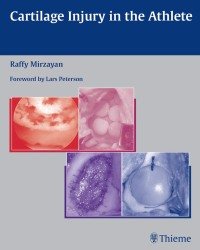 R. Mirzayan - Cartilage Injury in the Athlete