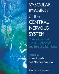 Joana N. Ramalho - Vascular Imaging of the Central Nervous System