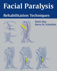 Mark May - Facial Paralysis. Rehabilitation Techniques