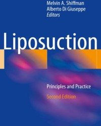 Melvin A. Shiffman - Liposuction (Second edition, 2016)