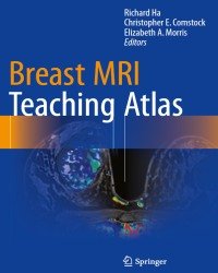 Richard Ha - Breast MRI. Teaching Atlas (2017)