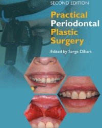 Serge Dibart - Practical Periodontal Plastic Surgery (2017)