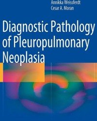 Annikka Weissferdt - Diagnostic Pathology of Pleuropulmonary Neoplasia