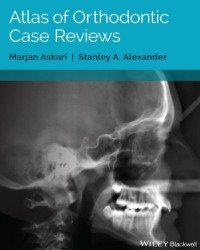 Marjan Askari - Atlas of Orthodontic Case Reviews (2017)