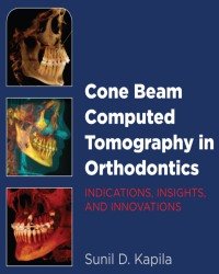 Sunil D. Kapila - Cone Beam Computed Tomography in Orthodontics
