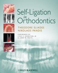 Theodore Eliades - Self-Ligation in Orthodontics
