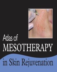 Antonella Tosti - Atlas of Mesotherapy in Skin Rejuvenation