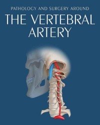 Bernard George - Pathology and Surgery Around the Vertebral Artery