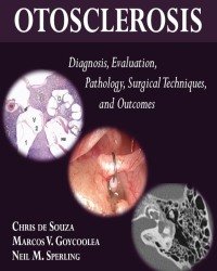Chris de Souza - Otosclerosis. Diagnosis, Evaluation, Pathology, Surgical Techniques, and Outcomes