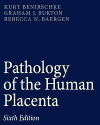 Kurt Benirschke - Pathology of the Human Placenta (Sixth edition)