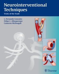 L. Fernando Gonzalez - Neurointerventional Techniques. Tricks of the Trade