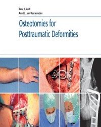 Rene Marti - Osteotomies for Posttraumatic Deformities
