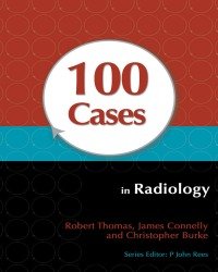 Robert Thomas - 100 Cases in Radiology