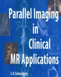 S. O. Schoenberg - Parallel Imaging in Clinical MR Applications