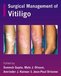 Somesh Gupta - Surgical Management of Vitiligo