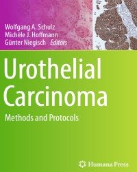 Wolfgang A. Schulz - Urothelial Carcinoma (2018)