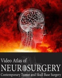 A. Quinones-Hinojosa - Video Atlas of Neurosurgery