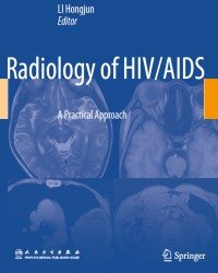 Hongjun Li - Radiology of HIV AIDS