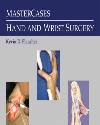 Kevin Plancher - Mastercases Hand and Wrist Surgery