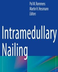 Pol M. Rommens - Intramedullary Nailing (2015)