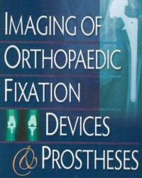 Thomas H. Berquist - Imaging of Orthopaedic Fixation Devices and Prostheses