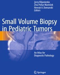 Jerzy Klijanienko - Small Volume Biopsy in Pediatric Tumors (2018)