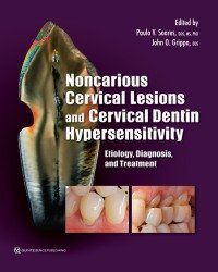 Paulo V. Soares - Noncarious Cervical Lesions and Cervical Dentin Hypersensitivity (2017)