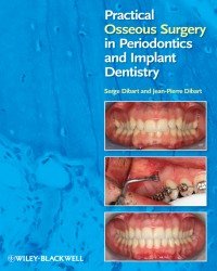 Serge Dibart - Practical Osseous Surgery in Periodontics and Implant Surgery