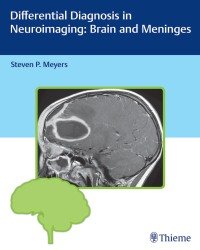 Steven P. Meyers - Differential Diagnosis in Neuroimaging. Brain and Meninges (2017)