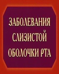 М. Волкова - Заболевания слизистой оболочки рта