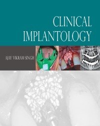 A. Singh - Clinical Implantology