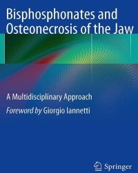 Francesco Saverio De Ponte - Bisphosphonates and Osteonecrosis of the Jaw