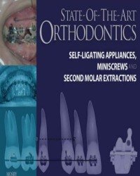 Hugo Trevisi - State of the Art Orthodontics